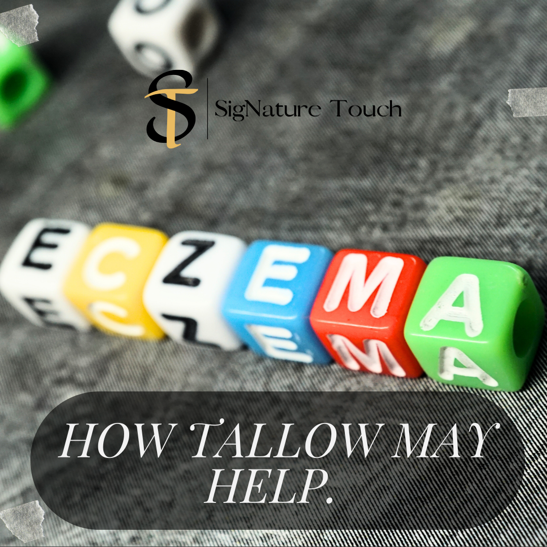 A Ray of Hope: Tallow's Gentle Touch on Severe Eczema